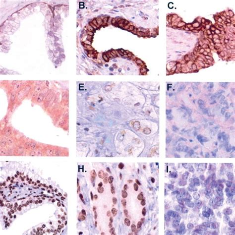 Examples Of The Immunohistochemical Staining Af Dusp1 Gi Sgk