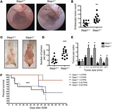 Jci Selenoprotein P Influences Colitis Induced Tumorigenesis By