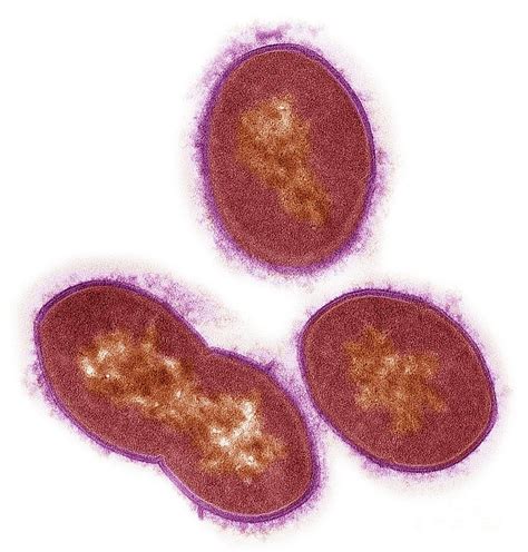 Streptococcus Bacteria Photograph By Steve Gschmeissnerscience Photo