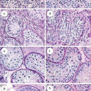 Representative Light Micrographs Of Immature Monkey Testicular Grafts