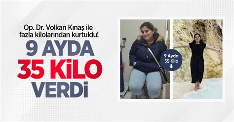 Op Dr Volkan Kınaş ile fazla kilolarından kurtuldu 9 ayda 35 kilo verdi