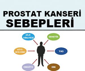 Prostat Kanseri Sebepleri Nelerdir Üroloji Uzmanı Prof Dr Mesut