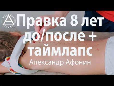 Детская мануальная терапия в 8 лет в Москве: до/после + таймлапс - YouTube