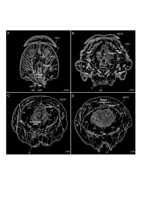 Axial μct Images Frontal Plane Of The Thorax And Head Of A Late L5d6