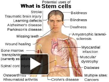 Ppt Stem Cell Of Prp And Bmc In Ca Calwest Stem Cell Powerpoint