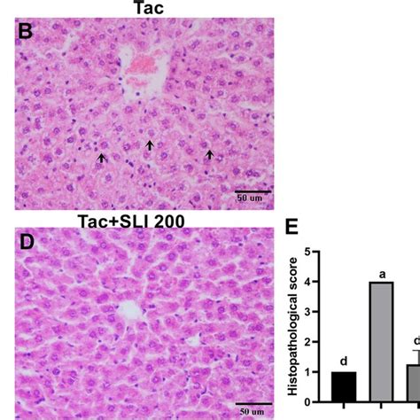 Hematoxylin Eosin Staining Liver A Hepatocyte And Sinusoids In The