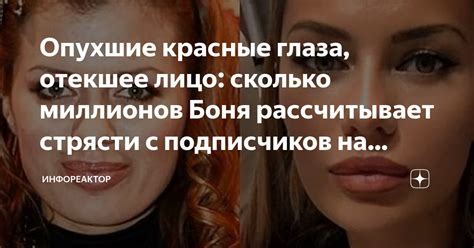 Опухшие красные глаза, отекшее лицо: сколько миллионов Боня ...
