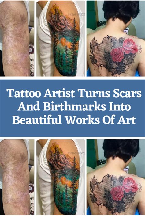 Tattoo Artist Turns Scars And Birthmarks Into Beautiful Works Of Art