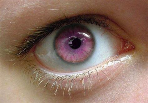 7 Rarest And Unusual Eye Colors That Looks Unreal Rare Eye Colors