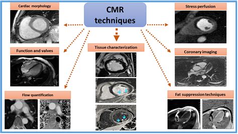 Cmr Component Of Value And Quality American College Of Cardiology