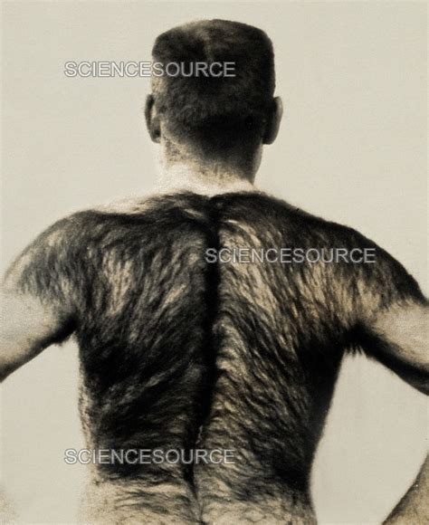 Hairy Back Neck at Myron Moses blog
