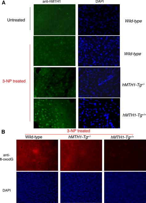 Mth Expression And Np Induced Oxidative Dna Damage In The Brain A