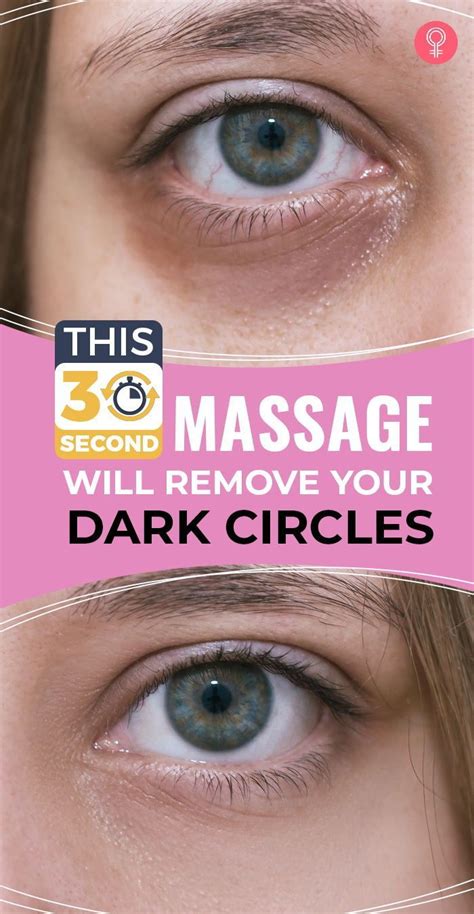 This 30 Second Massage Technique Will Help Get Rid Of Dark Circles Dark Eyes Circles Remedies