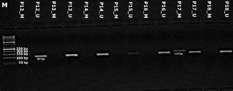 Representative Example Of Methylation Specific Polymerase Chain Download Scientific Diagram