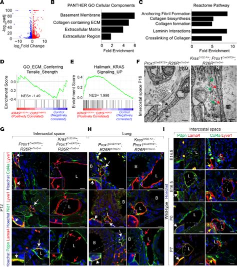 Pathological MAPK Activation Disrupts Lymphatic Basement Membrane A