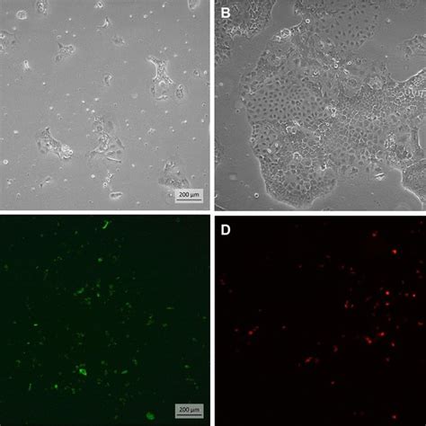 Images Of Caco Cells In Phase Contrast And Fluorescence Microscopy