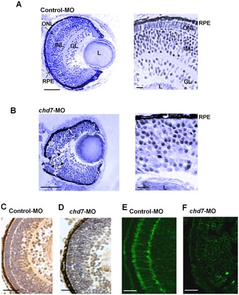 Retinal Organization Of Control Mo Embryos A And Chd Morphants B