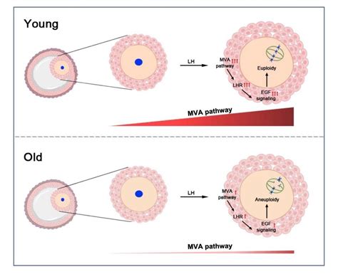 Granulosa Cell Mevalonate Pathway Abnormalities Contribute To Oocyte