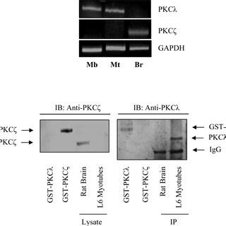 Effect Of Pkc Silencing On Deoxy H Glucose Dg Uptake With And