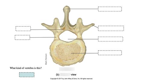 Lumbar Vertebra Diagram Quizlet