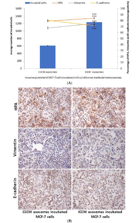 Invasive Potential Of MCF 7 Cells Shown By Matrigel Invasion Assay