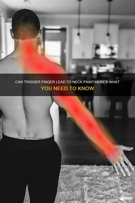 Can Trigger Finger Lead To Neck Pain Here S What You Need To Know Medshun