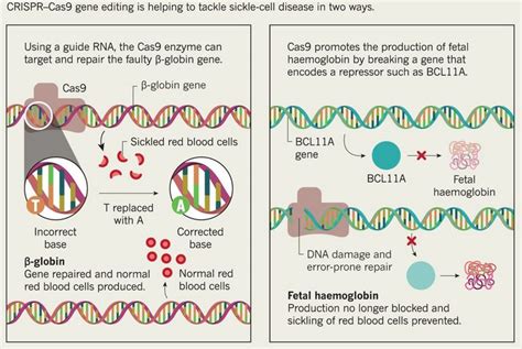 Crispr Cas Gene Therapy For Sickle Cell Disease Civilsdaily