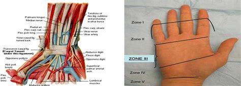 Volar Anatomy