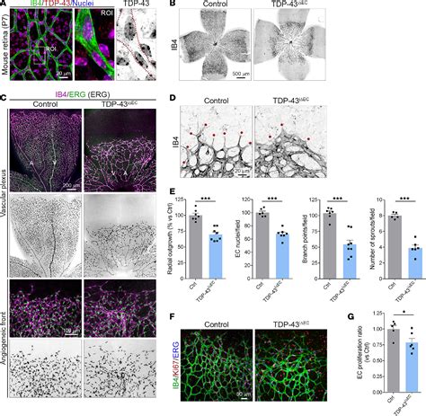 Figure 1 From Endothelial TDP 43 Controls Sprouting Angiogenesis And