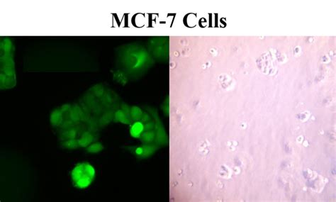 Mcf 7 Cells Culture Mcf 7 Cells