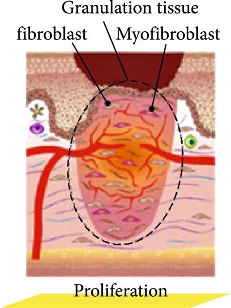 Ad Schematic Representation Of Normal Wound Healing Stages 18