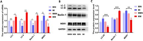 Reversal Of Glucocorticoid Resistance In Acute Lymphoblastic Leukemia