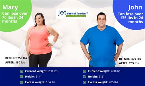 Gastric Bypass Weight Loss Chart Timeline Jet Medical Tourism