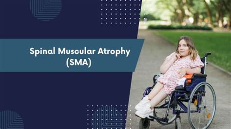 Spinal Muscular Atrophy (SMA)