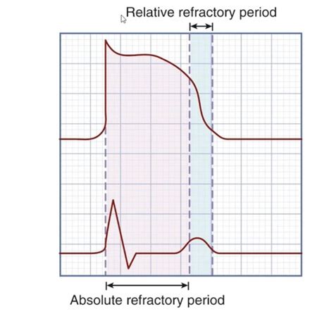 Ekg And Dysrhythmias Flashcards Quizlet