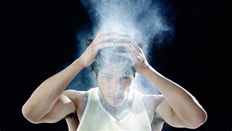 How To Fight Dandruff Best Solutions For Dandruff Mens Journal