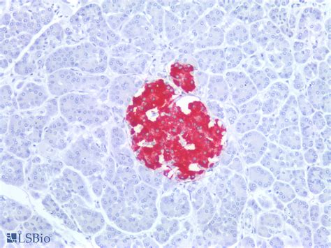 Pathplus Insulin Polyclonal Antibody Rabbit Anti Human Ihc Swb Lsbio