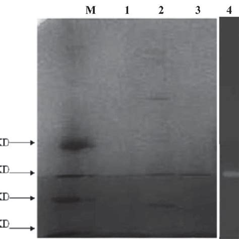 Sds Page And Activity Staining Analysis Of Purified A Amylase From M