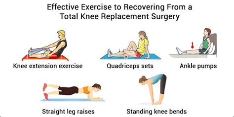 Total Knee Replacement Surgery-Effective Exercise to Recovering ...