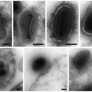 Immunoelectron Microscopy Bs C Cells Infected With Vf Lha At