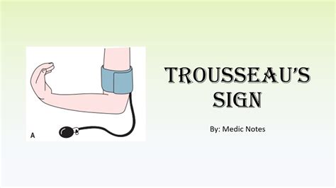 Trousseau's sign causes and pathophysiology - hypocalcemia, respiratory ...