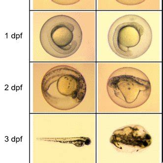 Representative Teratology Observed From Zebrafish Embryos Treated With