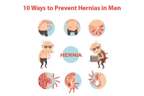 Ways To Prevent Hernias In Men Dr Abhijit Gotkhinde