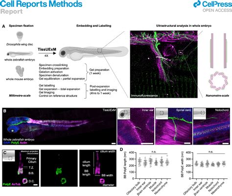 Figure 1 From TissUExM Enables Quantitative Ultrastructural Analysis In