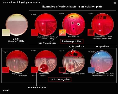 Preliminary identification of non fastidious bacteria on Endo agar with ...