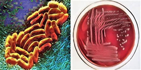 Morphology And Culture Characteristics Of Klebsiella Pneumoniae