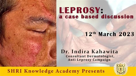 LEPROSY A Case Based Discussion YouTube