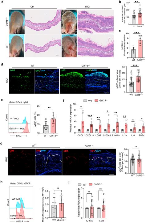 Decreasing Gdf15 Promotes Inflammatory Signals And Neutrophil