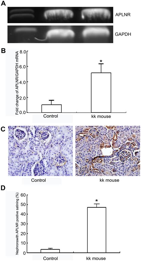 apelinaplnr expression   mouse kidney    aplnr mrna