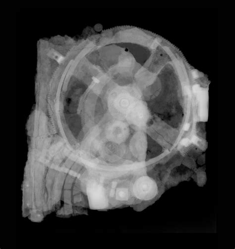 Antikythera Mechanism Attention Deficit Disorder Prosthetic Memory